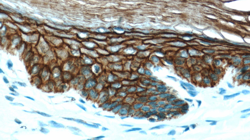 Immunohistochemical of paraffin-embedded human skin using Catalog No:114958(S100A14 antibody) at dilution of 1:50 (under 40x lens)