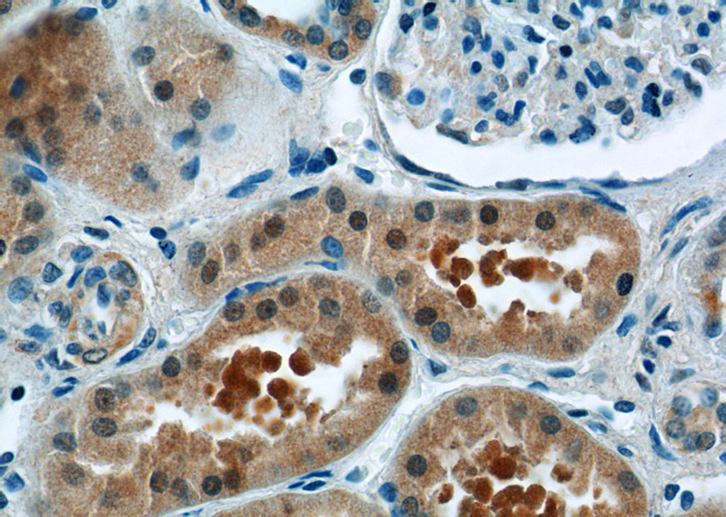 Immunohistochemistry of paraffin-embedded human kidney tissue slide using Catalog No:116910(ZBTB20 Antibody) at dilution of 1:50 (under 40x lens)