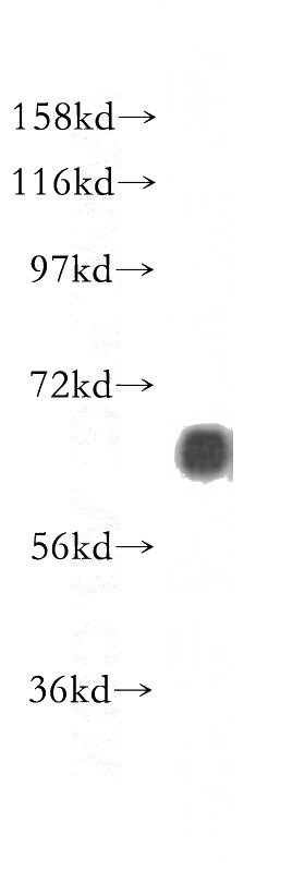 mouse brain tissue were subjected to SDS PAGE followed by western blot with Catalog No:112450(Marcksl1 antibody) at dilution of 1:500