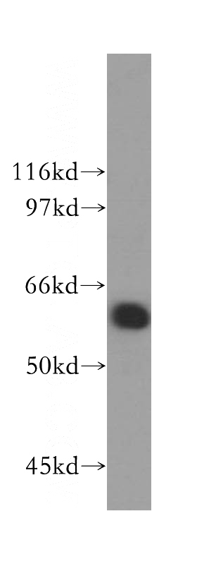 mouse testis tissue were subjected to SDS PAGE followed by western blot with Catalog No:114713(RIOK3 antibody) at dilution of 1:600