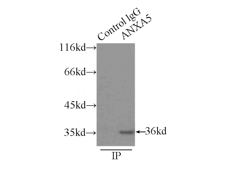 IP Result of anti-ANXA5 (IP:Catalog No:108096, 3ug; Detection:Catalog No:108096 1:500) with HeLa cells lysate 3000ug.
