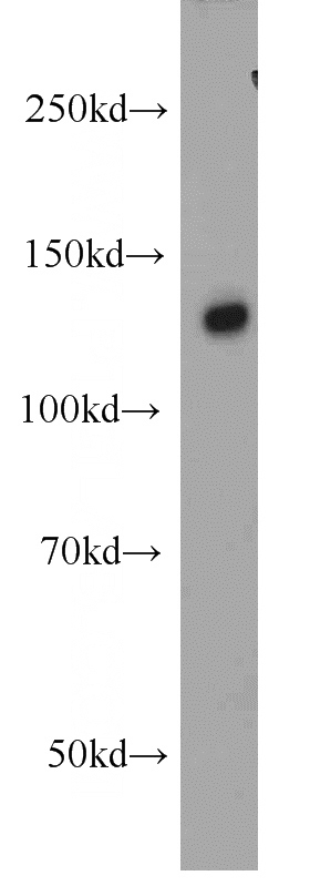 HeLa cells were subjected to SDS PAGE followed by western blot with Catalog No:115669(SREBF1 antibody) at dilution of 1:500