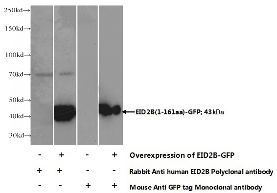 Transfected HEK-293 cells were subjected to SDS PAGE followed by western blot with Catalog No:110171(EID2B Antibody) at dilution of 1:1000