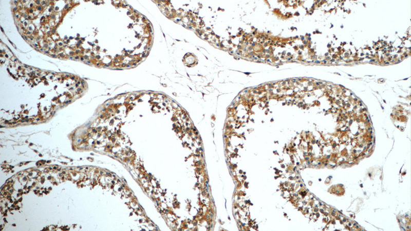 Immunohistochemistry of paraffin-embedded human testis tissue slide using Catalog No:115343(C20orf54 Antibody) at dilution of 1:50 (under 10x lens)