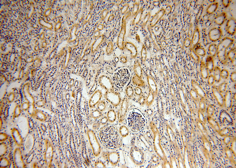 Immunohistochemical of paraffin-embedded human kidney using Catalog No:111789(INF2 antibody) at dilution of 1:100 (under 10x lens)