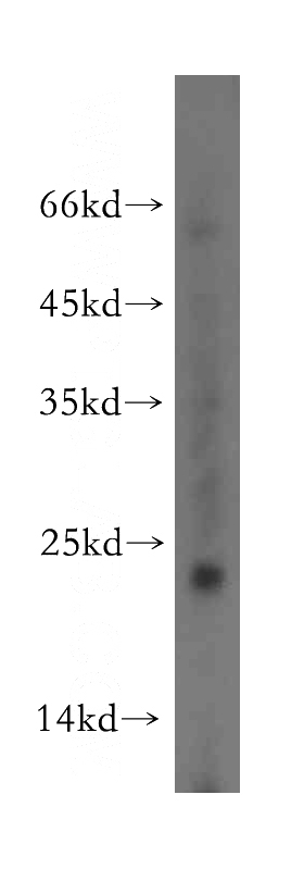 mouse small intestine tissue were subjected to SDS PAGE followed by western blot with Catalog No:110146(FXYD5 antibody) at dilution of 1:500