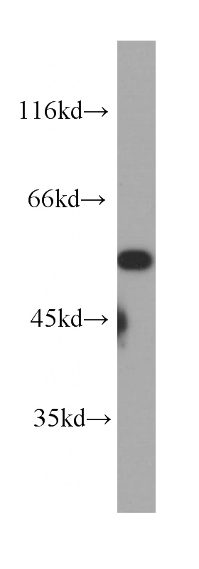 MCF7 cells were subjected to SDS PAGE followed by western blot with Catalog No:107156(CHRNA7 antibody) at dilution of 1:1000