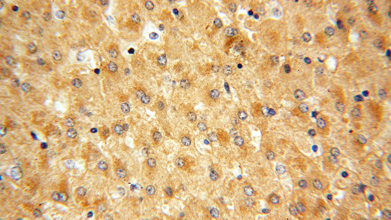 Immunohistochemical of paraffin-embedded human liver using Catalog No:108031(APOF antibody) at dilution of 1:50 (under 40x lens)