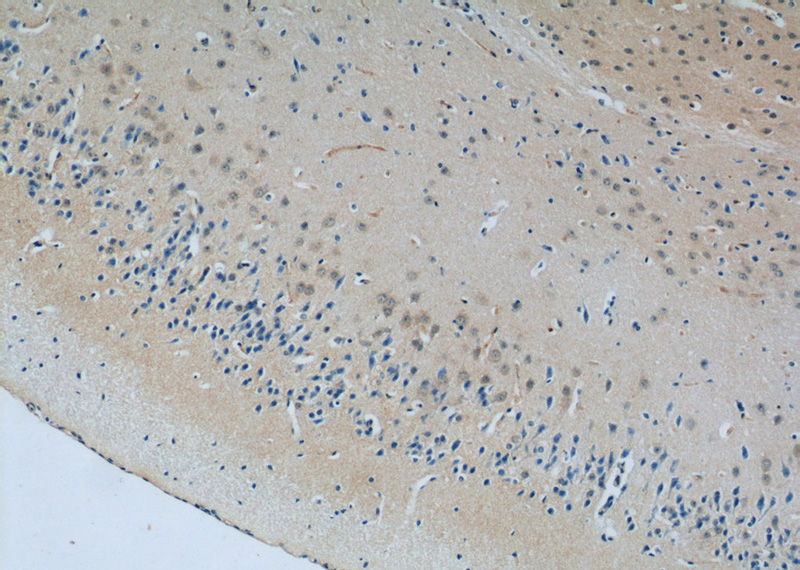 Immunohistochemistry of paraffin-embedded mouse brain tissue slide using Catalog No:114996(SCHIP1 Antibody) at dilution of 1:50 (under 10x lens)