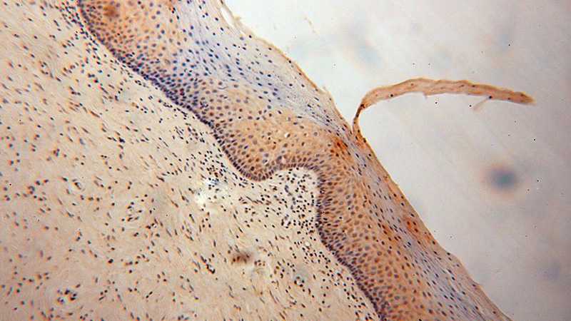 Immunohistochemical of paraffin-embedded human cervix using Catalog No:116613(UNC45A antibody) at dilution of 1:100 (under 10x lens)