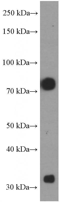 human plasma tissue were subjected to SDS PAGE followed by western blot with Catalog No:107555(A1BG Antibody) at dilution of 1:8000