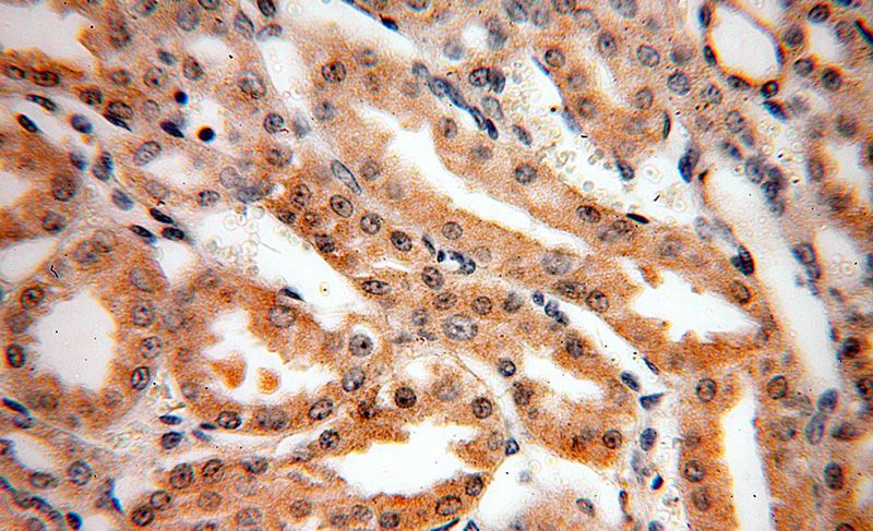 Immunohistochemical of paraffin-embedded human kidney using Catalog No:109312(CIB4 antibody) at dilution of 1:50 (under 40x lens)