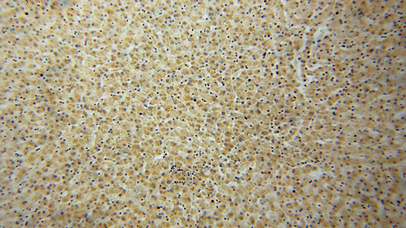 Immunohistochemical of paraffin-embedded human liver using Catalog No:114365(PC antibody) at dilution of 1:50 (under 10x lens)