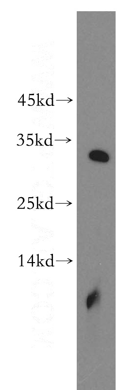 human brain tissue were subjected to SDS PAGE followed by western blot with Catalog No:114782(ROGDI antibody) at dilution of 1:500