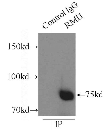 IP Result of anti-RMI1 (IP:Catalog No:114722, 3ug; Detection:Catalog No:114722 1:1500) with HeLa cells lysate 3800ug.