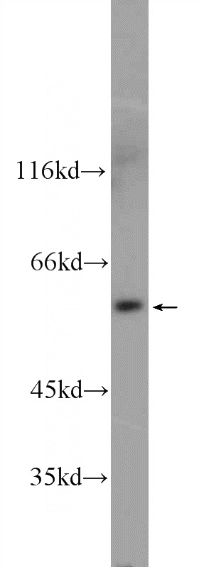 MDA-MB-453s cells were subjected to SDS PAGE followed by western blot with Catalog No:116465(UAP1L1 Antibody) at dilution of 1:600