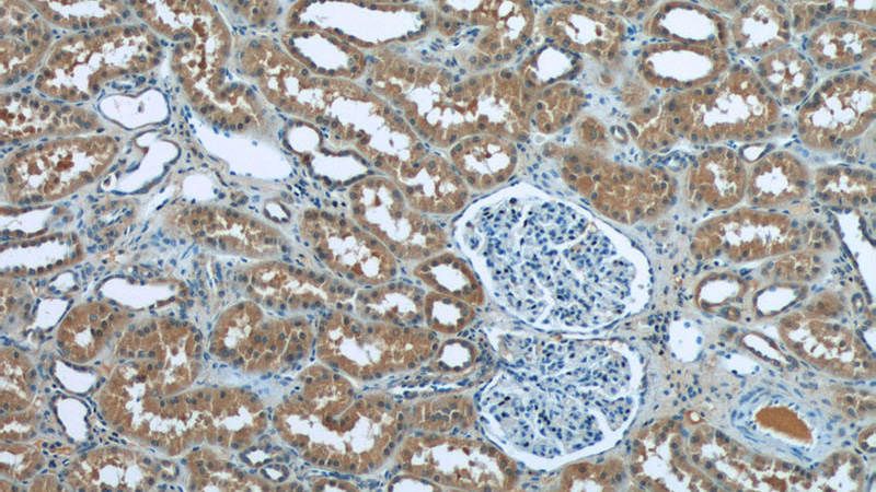 Immunohistochemistry of paraffin-embedded human kidney tissue slide using Catalog No:114803(RPGR Antibody) at dilution of 1:50 (under 10x lens)