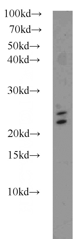 mouse brain tissue were subjected to SDS PAGE followed by western blot with Catalog No:114440(RAB3A-specific antibody) at dilution of 1:1000