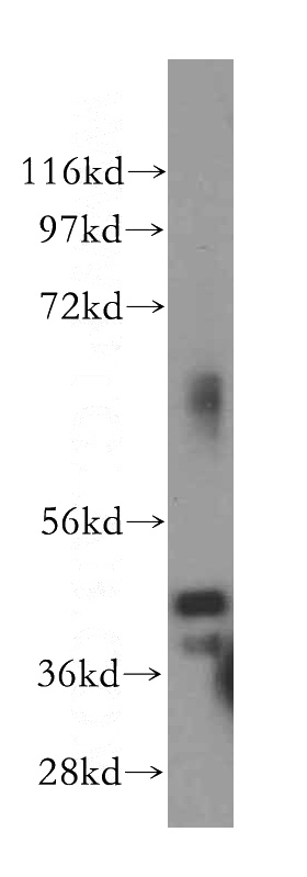 human brain tissue were subjected to SDS PAGE followed by western blot with Catalog No:114050(POLR3D antibody) at dilution of 1:500