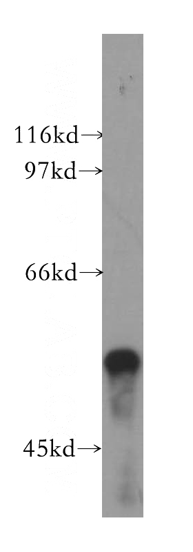 mouse pancreas tissue were subjected to SDS PAGE followed by western blot with Catalog No:115875(TBL1X antibody) at dilution of 1:400