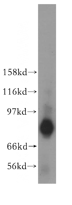 mouse testis tissue were subjected to SDS PAGE followed by western blot with Catalog No:115968(TACC2 antibody) at dilution of 1:500