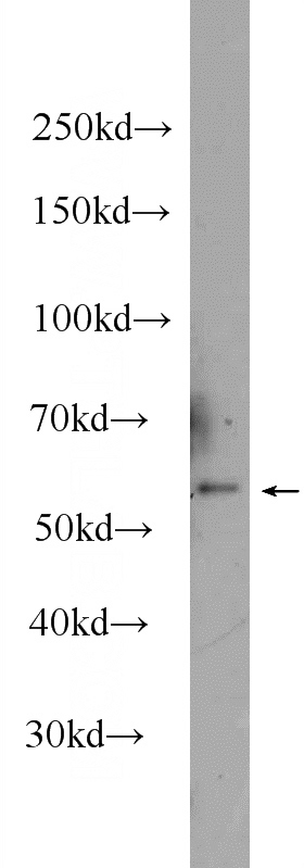 CHO cells were subjected to SDS PAGE followed by western blot with Catalog No:114914(RPS6KL1 Antibody) at dilution of 1:600