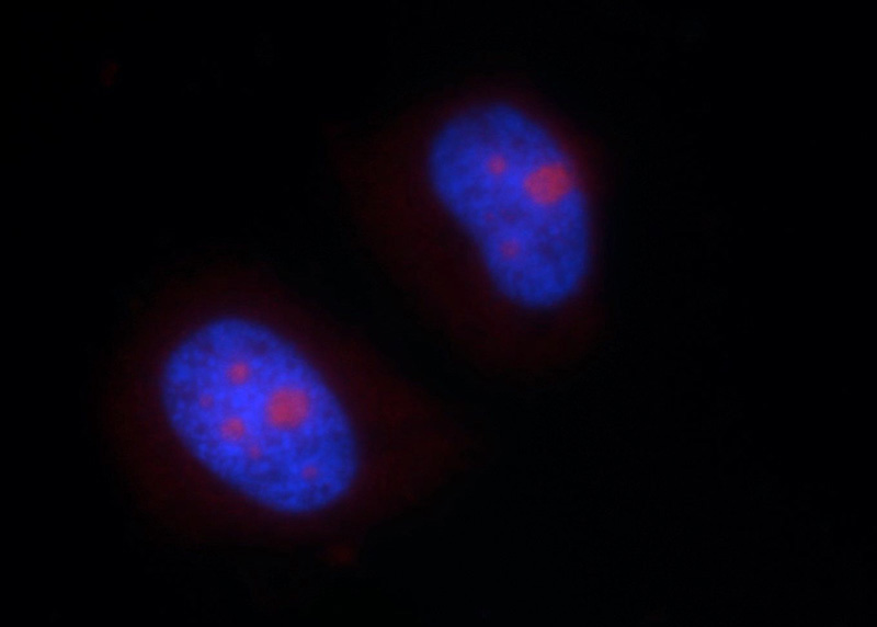 Immunofluorescent analysis of HeLa cells using Catalog No:113180(NHP2L1 Antibody) at dilution of 1:25 and Rhodamine-Goat anti-Rabbit IgG