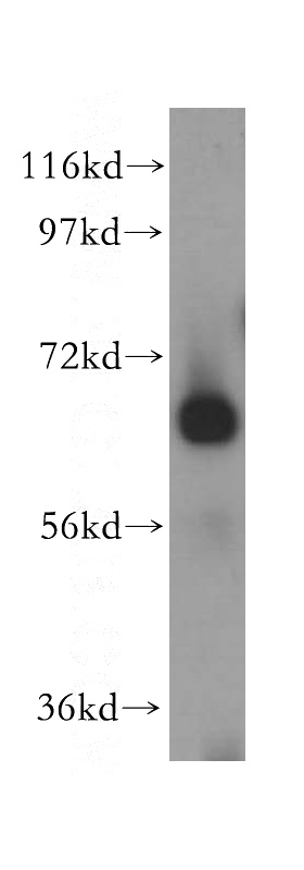 human liver tissue were subjected to SDS PAGE followed by western blot with Catalog No:117145(CEL antibody) at dilution of 1:500