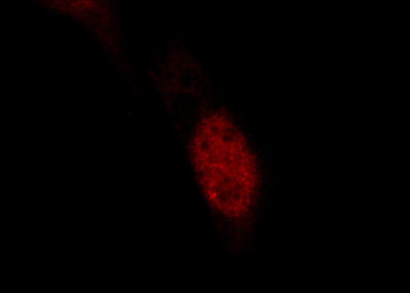 Immunofluorescent analysis of NIH/3T3 cells using Catalog No:111899(JUN Antibody) at dilution of 1:25 and Rhodamine-Goat anti-Rabbit IgG