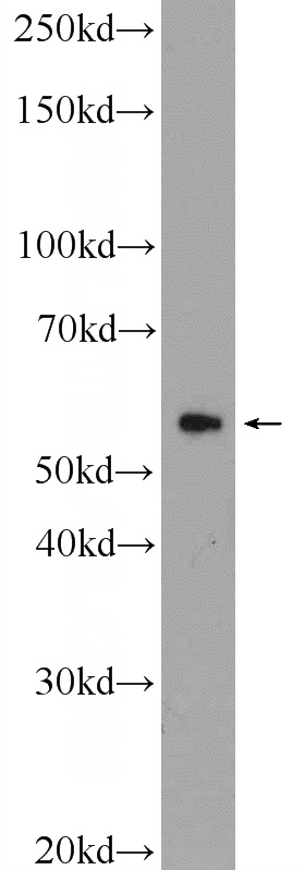 mouse testis tissue were subjected to SDS PAGE followed by western blot with Catalog No:108984(CCDC65 Antibody) at dilution of 1:1000