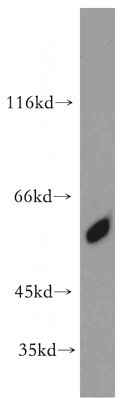 DU 145 cells were subjected to SDS PAGE followed by western blot with Catalog No:108901(CBLL1 antibody) at dilution of 1:500