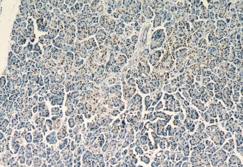 Immunohistochemistry of paraffin-embedded human pancreas tissue slide using Catalog No:116663(UBR2 Antibody) at dilution of 1:50(under 10x lens)