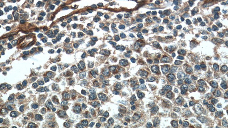Immunohistochemistry of paraffin-embedded human tonsillitis tissue slide using Catalog No:115034(SDPR Antibody) at dilution of 1:50 (under 40x lens)