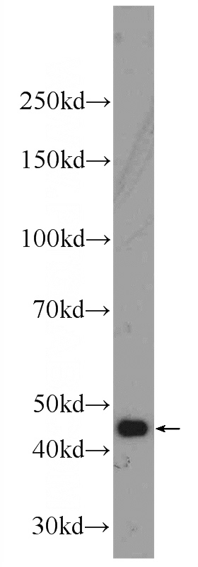 L02 cells were subjected to SDS PAGE followed by western blot with Catalog No:112975(MYLK4 Antibody) at dilution of 1:1000