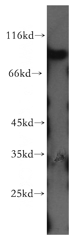 human brain tissue were subjected to SDS PAGE followed by western blot with Catalog No:108130(APBB2 antibody) at dilution of 1:300