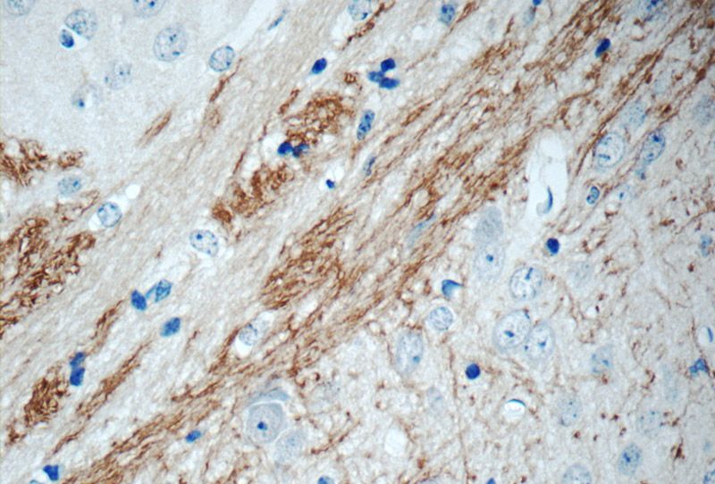 Immunohistochemistry of paraffin-embedded mouse brain tissue slide using Catalog No:110351(EPHA6-Specific Antibody) at dilution of 1:50 (under 40x lens)