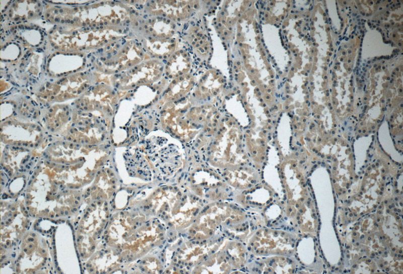 Immunohistochemistry of paraffin-embedded human kidney tissue slide using Catalog No:107893(ADM Antibody) at dilution of 1:50 (under 10x lens)