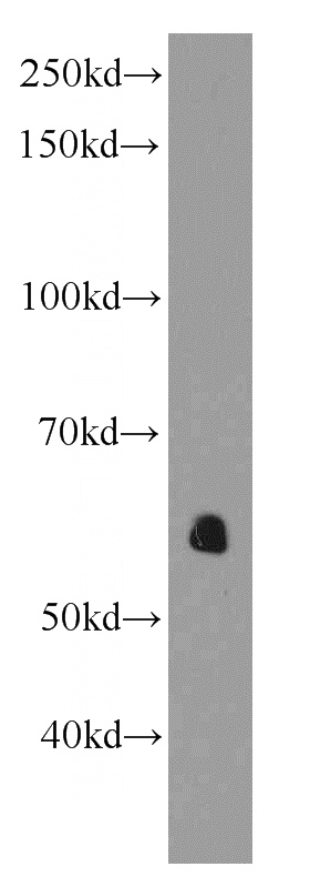 HeLa cells were subjected to SDS PAGE followed by western blot with Catalog No:107561(AEBP2 antibody) at dilution of 1:1000