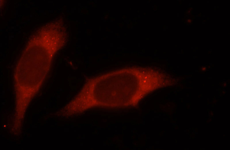 Immunofluorescent analysis of MCF-7 cells, using NMT1 antibody Catalog No:113255 at 1:50 dilution and Rhodamine-labeled goat anti-rabbit IgG (red).