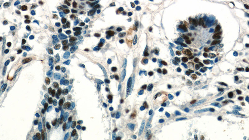 Immunohistochemistry of paraffin-embedded human small intestine tissue slide using Catalog No:117266(ZSCAN20 Antibody) at dilution of 1:100