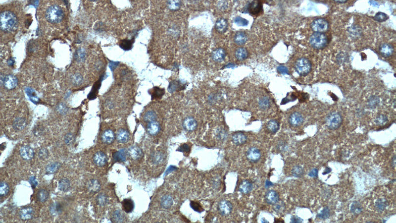 Immunohistochemistry of paraffin-embedded human liver tissue slide using Catalog No:111689(IGFBP7 Antibody) at dilution of 1:50 (under 40x lens)