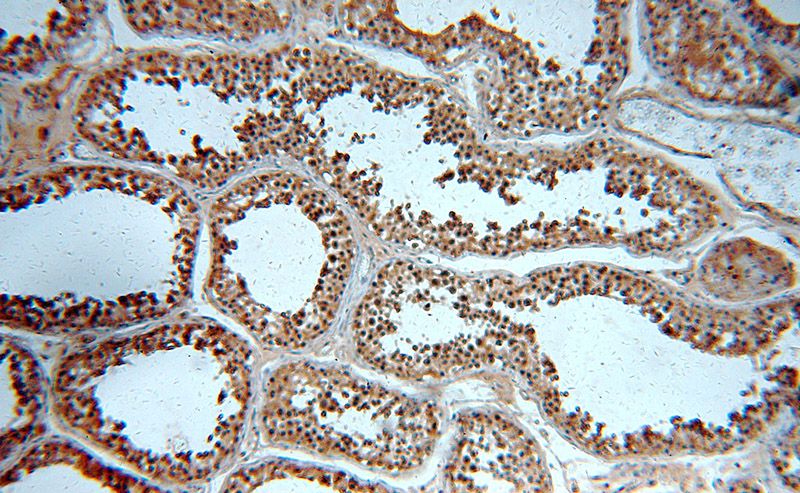 Immunohistochemical of paraffin-embedded human testis using Catalog No:110882(GATA4-Specific antibody) at dilution of 1:50 (under 10x lens)
