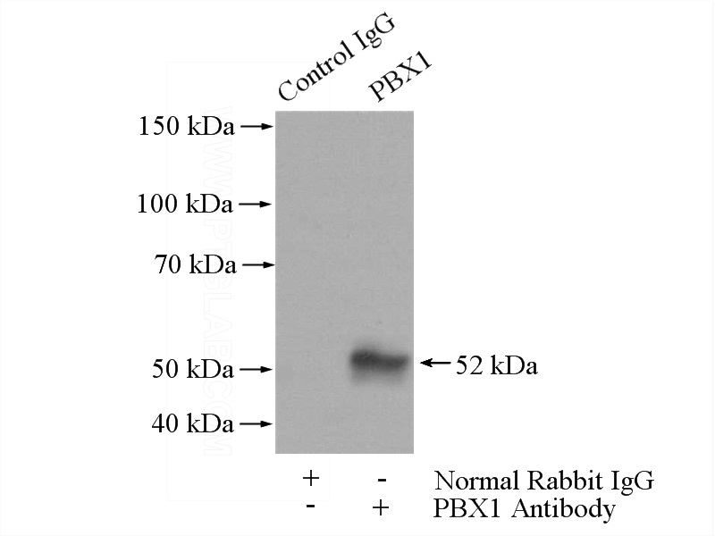 IP Result of anti-PBX1 (IP:Catalog No:113614, 4ug; Detection:Catalog No:113614 1:500) with A2780 cells lysate 1000ug.