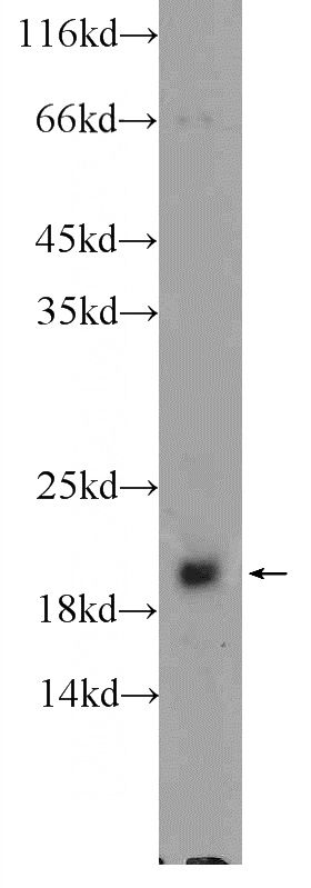 HEK-293 cells were subjected to SDS PAGE followed by western blot with Catalog No:111460(HRAS-Specific Antibody) at dilution of 1:300