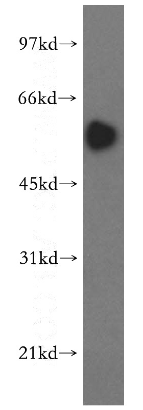 HeLa cells were subjected to SDS PAGE followed by western blot with Catalog No:115423(SMAD9 antibody) at dilution of 1:500