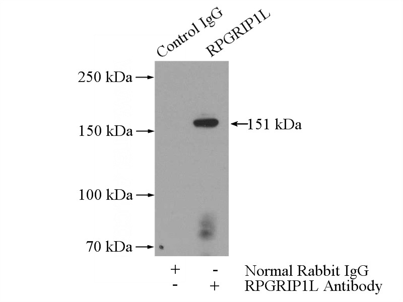 IP Result of anti-RPGRIP1L (IP:Catalog No:114805, 4ug; Detection:Catalog No:114805 1:700) with HEK-293 cells lysate 3200ug.