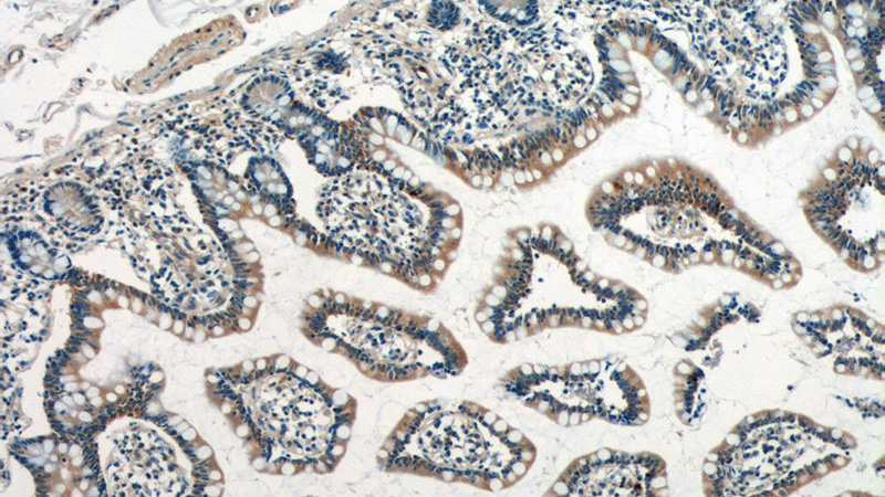 Immunohistochemistry of paraffin-embedded human small intestine tissue slide using Catalog No:109849(DEFA1 Antibody) at dilution of 1:50 (under 10x lens)