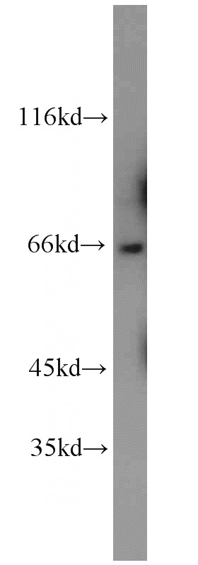 mouse brain tissue were subjected to SDS PAGE followed by western blot with Catalog No:110769(GAB3-Specific antibody) at dilution of 1:500