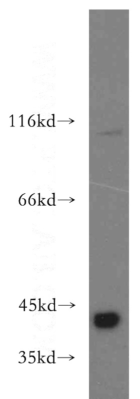 HEK-293 cells were subjected to SDS PAGE followed by western blot with Catalog No:115392(SMN2 antibody) at dilution of 1:800
