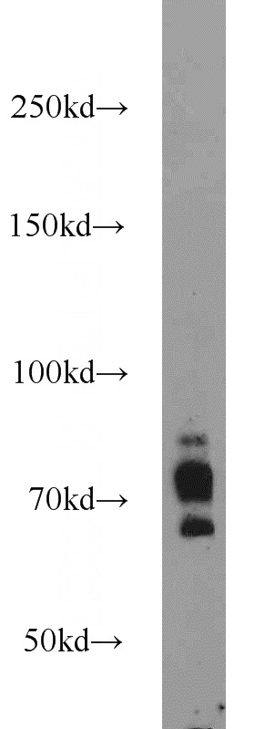 mouse brain tissue were subjected to SDS PAGE followed by western blot with Catalog No:115504(SORCS1 antibody) at dilution of 1:1000
